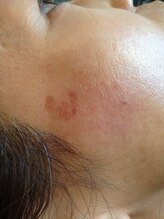 アイエステ(Ai esthe)/