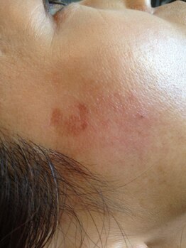 アイエステ(Ai esthe)/