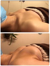 美人バスト 吉祥寺店/バストアップ　★☆症例写真☆★