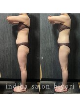 ヒヨリ(hiyori)/《before/after》body