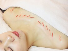 メイロン 恵比寿Mana院(meilong)/デコルテ美鍼