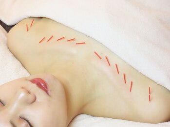 メイロン 恵比寿Mana院(meilong)/デコルテ美鍼