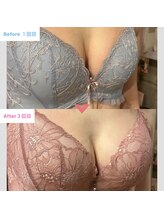 ビウラ(BIURA)/【40代】3回コース集中ケア