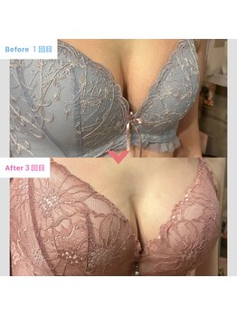 ビウラ(BIURA)/【40代】3回コース集中ケア