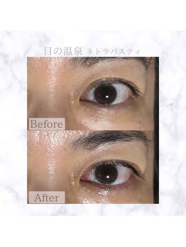 クロレ(Colorer)/ネトラバ