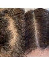 グラーティア(gratia)/プロセル育毛促進トリートメント