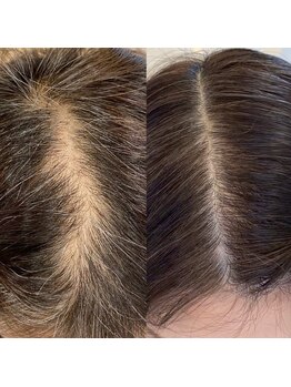 グラーティア(gratia)/プロセル育毛促進トリートメント