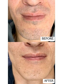 バディーズ(BUDDieS)/40代