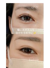 アイシック 勝どき(eyechic)/まつげパーマ　勝どき月島晴海