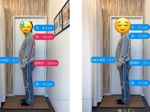 ナオル整体 札幌院(NAORU整体)/札幌円山/整体/姿勢矯正/猫背