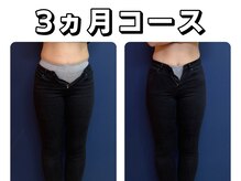 久留米スポーツ整骨院 整体院/エステ◆痩身インディバエステ