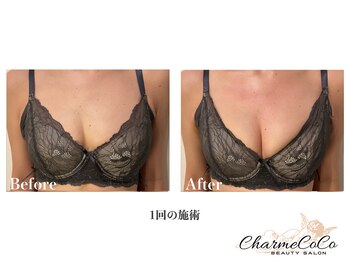 シャルムココ 蔵前店(CharmeCoCo)/お客様Before→After