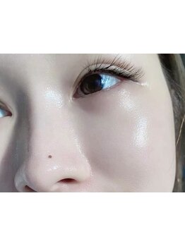 美白ケアをしたい