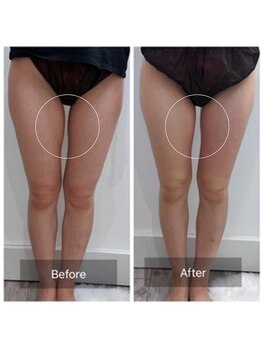 ウィズ ユー ビューティ(with U beauty)/隙間!