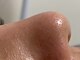 アガリア(agalia)の写真/【プロによる本格毛穴洗浄！】韓国式毛穴洗浄でお肌がつるつるに◎施術後の綺麗さに驚き！パーツ選択可能♪