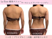 ラエッセ(La Esse)/式まで時間が無い方必見！