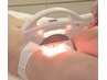 【V.I.O脱毛】刺激を抑えても効果は期待◎抑毛鎮静美白ローション付き☆