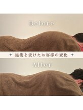 フェルナ 東新宿(FERNA)/反り腰矯正