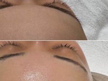 アンヘルハート(Angel heart)の写真/【フォトスタジオ併設】《肌トーン+艶UP》結婚式前はお顔ワックス+お顔エステがおすすめ★