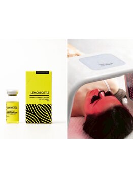 小顔になりたい