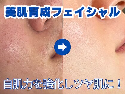 メンズビューティサロン ブレス(bless)の写真