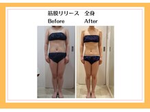 リヴェーヌ 富山店/全身　筋膜リリース