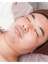 エモーションプラス(Emotion plus)/毎朝の髭剃りもうやめませんか？