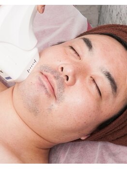 エモーションプラス(Emotion plus)/毎朝の髭剃りもうやめませんか？