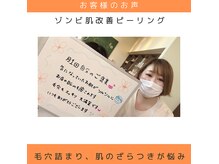パルティノ 高崎店の雰囲気（リピーター続出◎ピーリング・ごわつき・皮脂ニキビケア緩和に◎）
