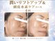 リベルテの写真/頭皮のケアと合わせて顔スッキリ！潤い、ハリ、艶を実感して理想のフェイスラインへ導く贅沢エステ◎