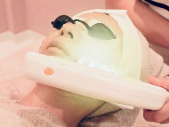 チップ(chip)の写真/【都度払い☆ご新規様¥5,000】SHR光脱毛で産毛ケア♪もみあげ、眉上、おでこの生え際デザイン込み◎
