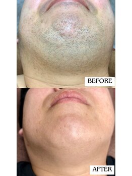 バディーズ(BUDDieS)/40代