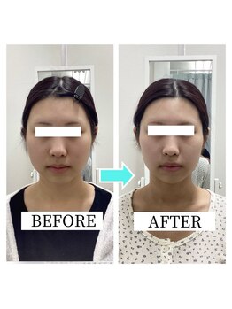 シンメトリー 千葉店/コンプレックスから解放される♪