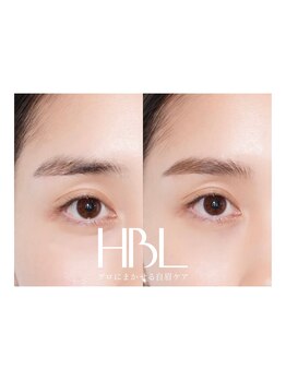 ティアム(Tiam)/ハリウッドブロウリフト