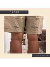 ソロウノ 平和島本院/膝の調整　O脚改善