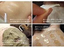 マツヤニホットセラピー肌悩み根本的に解決/くすみ/毛穴/黒ずみ