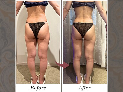 リボーン(boju reborn)の写真