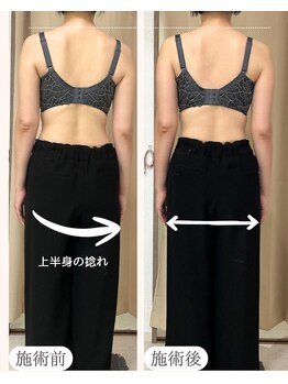 ワム(Wom)/バストケアの為の骨格調整/枚方