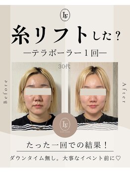 リュクスルーム(Luxe room)の写真/【テラボーラー導入店】表情筋を鍛えることでたるみ・むくみなどの年齢によるお肌のお悩みに働きかけます◎