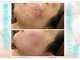 リヴェーヌ 呉羽店(Riverne)の写真/【人生最後の肌質改善へ】肌荒れ、乾燥、毛穴、くすみ！！贅沢に生コラーゲンを使用。肌結果へ導きます♪