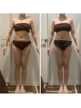 痩身脱毛専門店 グレイスボディ MEGAドンキホーテ三郷店(Gracebody)/ファスティング7日間プログラム