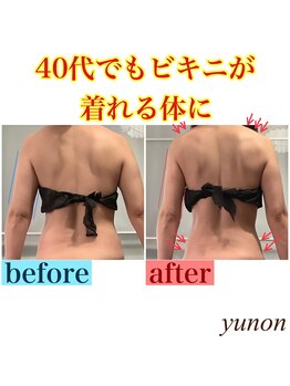 ユノン(yunon)/ビフォーアフター★