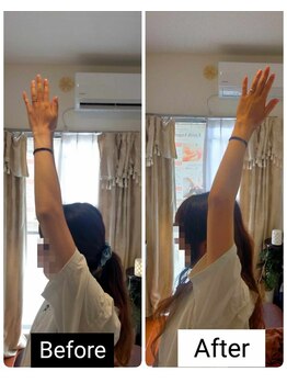 アース エンジェル整体院/ビフォアフ 肩こり ストレッチ