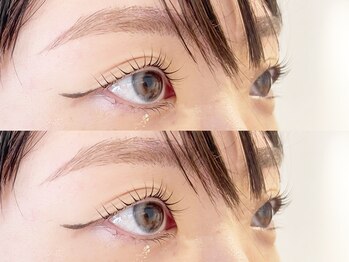 ロヌ(RONU)/ラッシュリフト＋アイブロウ