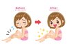 〈キッズ脱毛〉全身 ¥5500