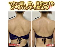 コプタ(Coputa)の雰囲気（↑肩,肩甲骨,体の厚さがスッキリと♪背筋がピッとし美姿勢にも！）
