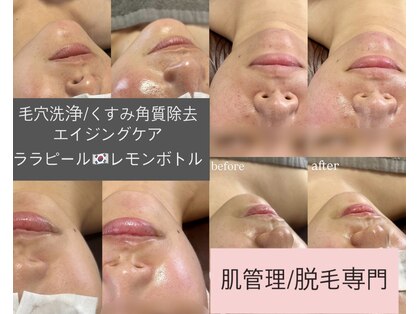 ルチルス(Rutiles)の写真