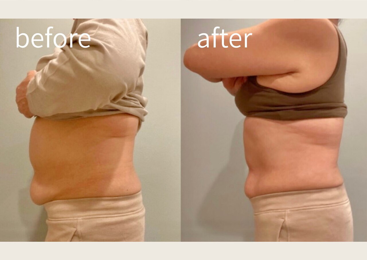 値下げ！ギャビプラス エステ ダイエット お客様の声 ～施術実績～｜エステのエルセーヌ