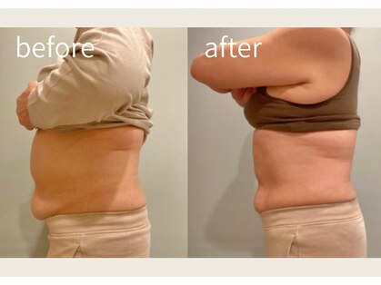 フラットベリー 恵比寿(Flat BELLY)の写真