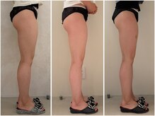 カレンジェビューティー(CarengeBeauty)/ヒップアップ